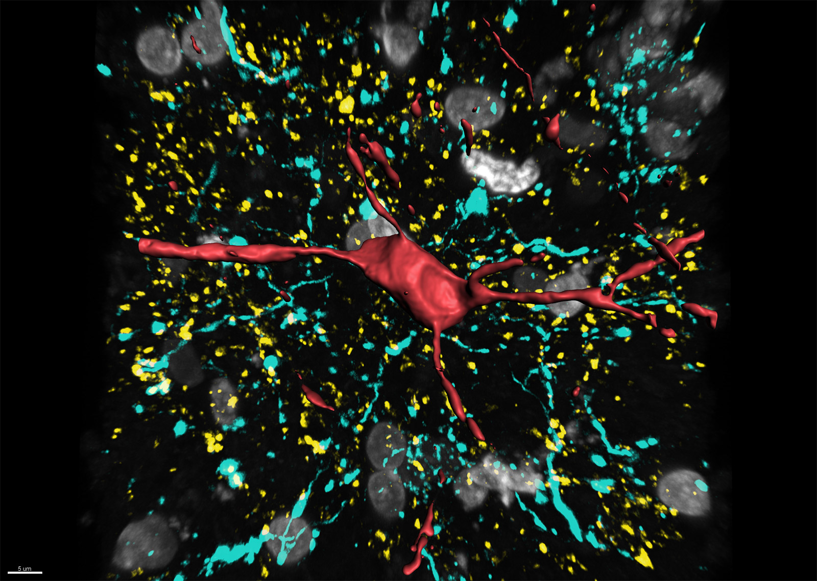 神经元及其星状结构