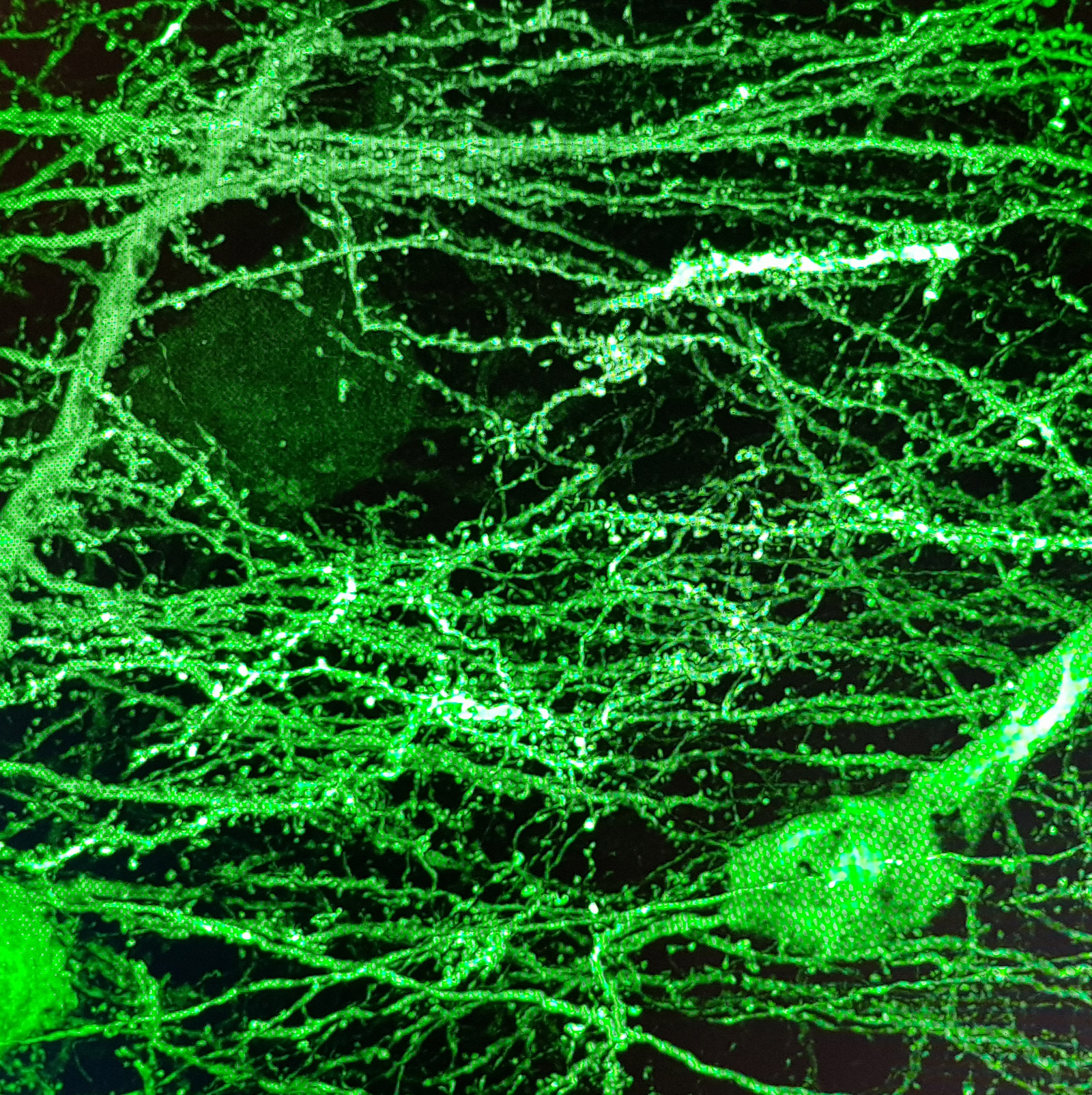玫瑰与荆棘（神经元突触棘的形象化表述）